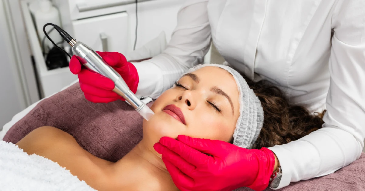The Science Behind Microneedling: How It Stimulates Collagen Production