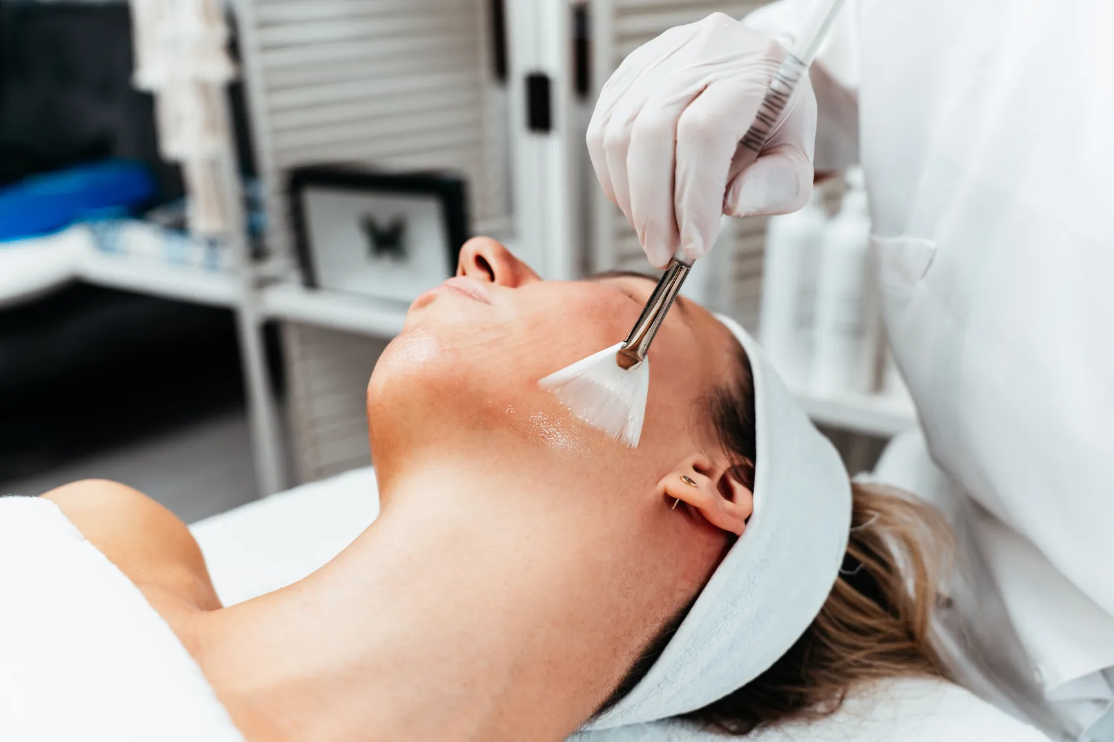 Chemical Peels